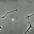Eksperimentą laboratorijoje atlikę mokslininkai įamžino įspūdingą neuronų susijungimą