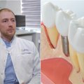 Gydytojas atsakė, kiek ilgai tarnauja dantų implantai ir, ar gali jie neprigyti