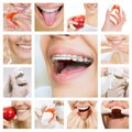 Visa tiesa apie dantų tiesinimą: kada neverta skubėti