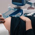 Tokių operacijų Lietuvoje dar nebuvo: Kauno klinikose atliekamas gimdos kaklelio apsiuvimas