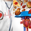 4 populiarūs maisto produktai, kurie kenkia jūsų širdžiai, – ekspertai perspėja