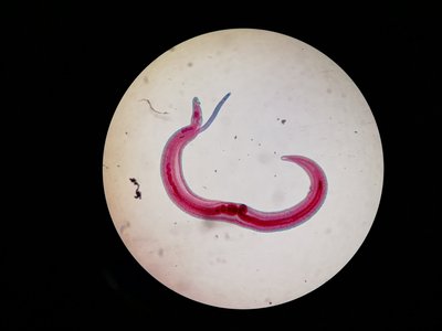 Šistosomatozę sukeliantys parazitai prasiskverbia per odą.