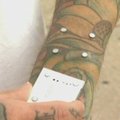 Vyras į paodį implantavosi magnetus „iPod“ grotuvui pritvirtinti