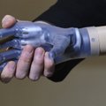 „120s“ žinios: bioninė ranka lietuviui ir sugrįžtantys 1l talpos gesintuvai