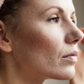 Kaip sustabdyti odos senėjimą? Įvardijo priemonę, kuri gali padėti