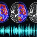 Smegenyse aptiktas unikalus reiškinys: išgirdę šiuos garsus žmonės patyrė ekstazę, prilygusią marihuanos ar amfetamino poveikiui