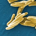 Atsitiktinai atrastas vaistas nuo tuberkuliozės – visiems puikiai žinomas junginys