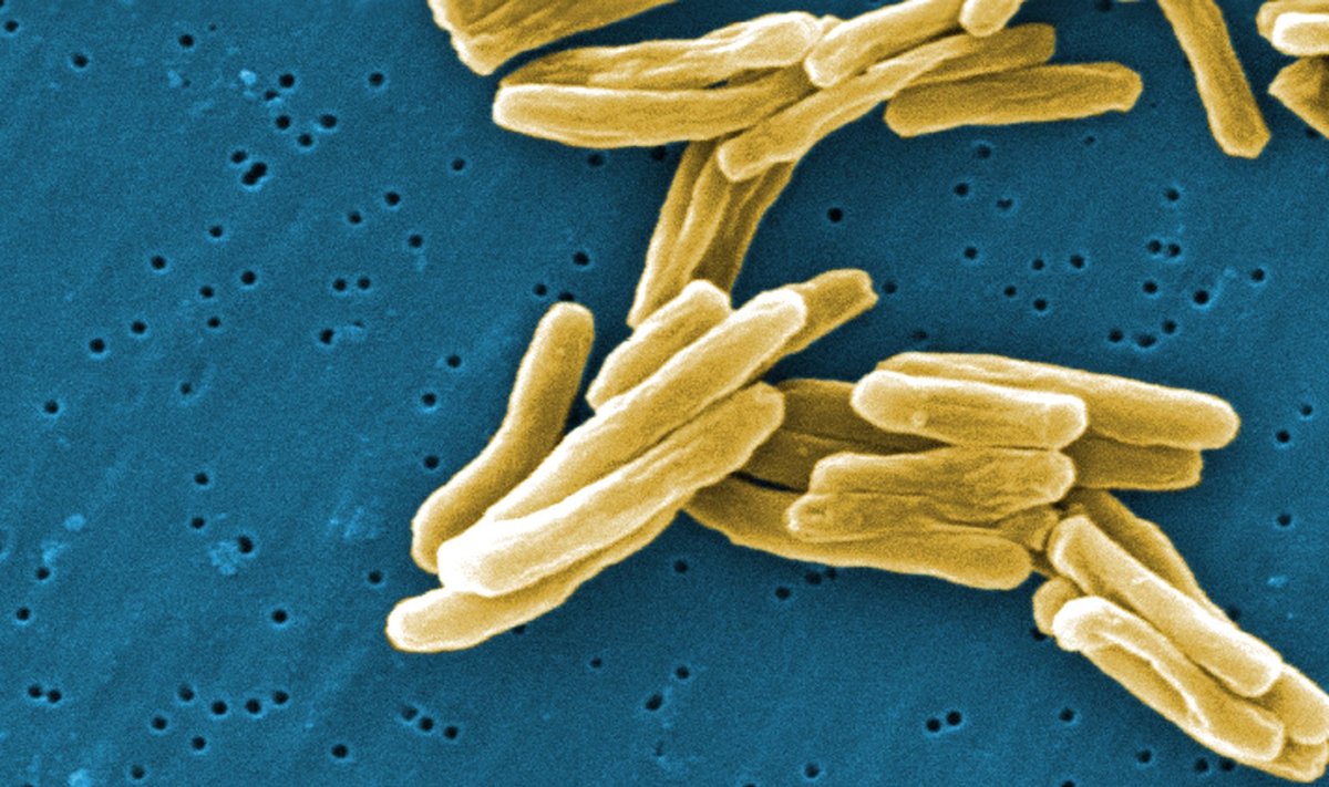 Tuberkuliozės sukėlėjas - Mycobacterium tuberculosis