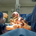 Svarbi ministerijos žinia – cezario operacijos galės būti atliekamos nėščiųjų pageidavimu
