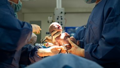 Svarbi ministerijos žinia – cezario operacijos galės būti atliekamos nėščiųjų pageidavimu