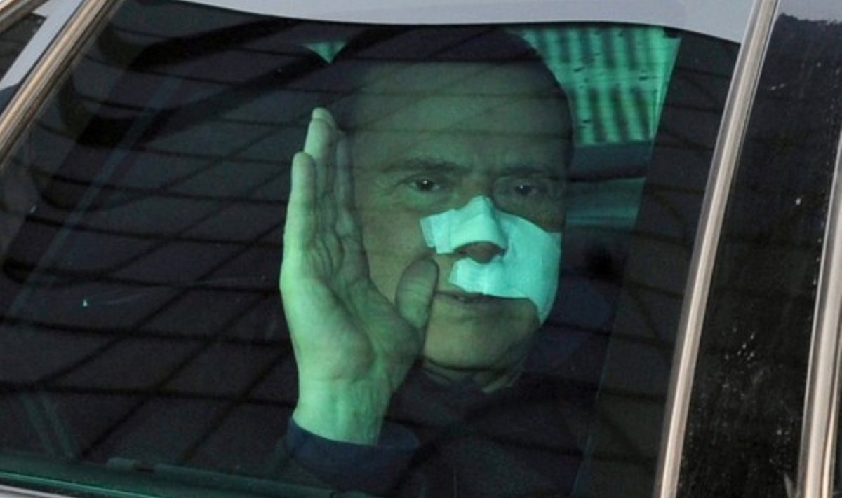 Italijos premjeras Silvio Berlusconi palieka Šv. Rafaelio ligoninę