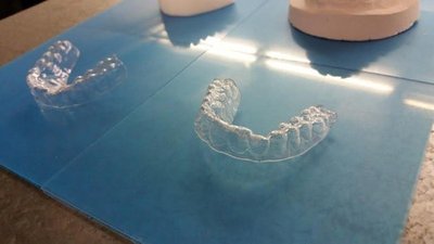 Dantis ištiesino 3D spausdintuvo pagalba