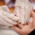 Klastingoji anemija: signalai, kad hemoglobinas pasiekė kritinę ligą