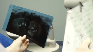 Po danties implantacijos prasidėjo 5 metus trunkantis košmaras – gali tekti protezuoti žandikaulį