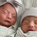 Kalifornijoje pasaulį išvydo unikali dvynukų pora – toks atvejis vos vienas iš 2 mln.