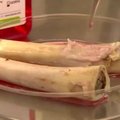 „Skystų kaulų“ technologija naudojama pažeistiems kaulams atstatyti