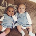 Vienas atvejis iš milijono: dvynukės gimė visiškai skirtingos