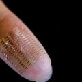 Mokslininkai sukūrė nanosuperkondensatorių, kurį galima implantuoti į žmogaus kūną: ateityje naudos vis dažniau