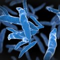 Tuberkuliozę galima išnaikinti iki 2045 metų