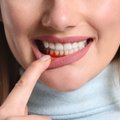 Žmogaus organizmo sveikatą atspindi ir sveikos dantenos: 12 jas stiprinančių maisto produktų
