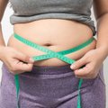 Dietistė patarė, kaip atsikratyti pavojingų pilvo riebalų: pakanka pakeisti kelis įpročius
