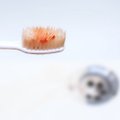 Kraujuojančios dantenos – itin pavojingas požymis: gali prasidėti skrandžio, žarnyno ligos