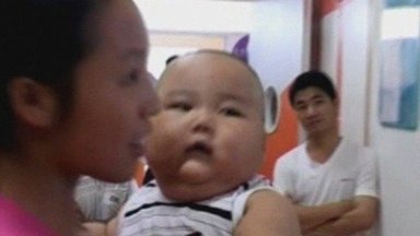 Dešimties mėnesių kūdikis Kinijoje sveria kaip šešiametis