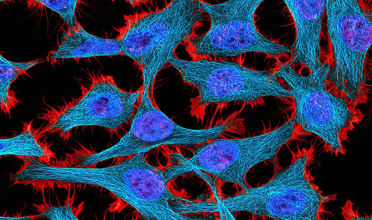 HeLa ląstelės: raudonai nudažytas aktinas, melsvai žaliai - mikrotubilės, mėlynai - branduoliai