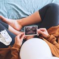 Tyrimas patvirtina – nėštumas sukelia dramatiškus pokyčius smegenyse