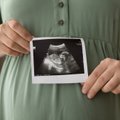 Galite tikėti arba ne: tikina, kad kūdikio lytį galima nustatyti gerokai anksčiau, nei pamato gydytojai