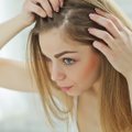 Specialistė pasakė, apie kokių vitaminų trūkumą byloja slenkantys plaukai: ypač svarbūs du elementai
