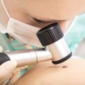 Dermatovenerologė apie apgamus: kokie požymiai rodo, kad jau formuojasi vėžys