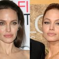 Kaip vieneri metai pakeitė MENOPAUZĘ išgyvenančią A. Jolie