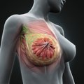 Krūtyse – dariniai, tačiau tai nebūtinai vėžys