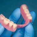 Gydytoja odontologė-ortopedė apžvelgė skirtingus dantų protezus: kuo jie skiriasi ir kada kuriuos pasirinkti