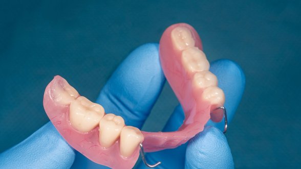 Gydytoja odontologė-ortopedė apžvelgė skirtingus dantų protezus: kuo jie skiriasi ir kada kuriuos pasirinkti