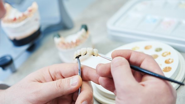 Teisę į valstybės kompensuojamą dantų protezavimą turi ne tik senjorai: pasakė, ką svarbu žinoti