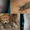Lietuvoje sutinkami kraujasiurbiai vabzdžiai: kokias ligas jie nešioja ir kaip apsisaugoti
