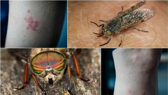 Lietuvoje sutinkami kraujasiurbiai vabzdžiai: kokias ligas jie nešioja ir kaip apsisaugoti