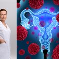 Nuo šios ligos kasmet miršta tūkstančiai moterų: simptomai, kurie išduoda gimdos kaklelio vėžį
