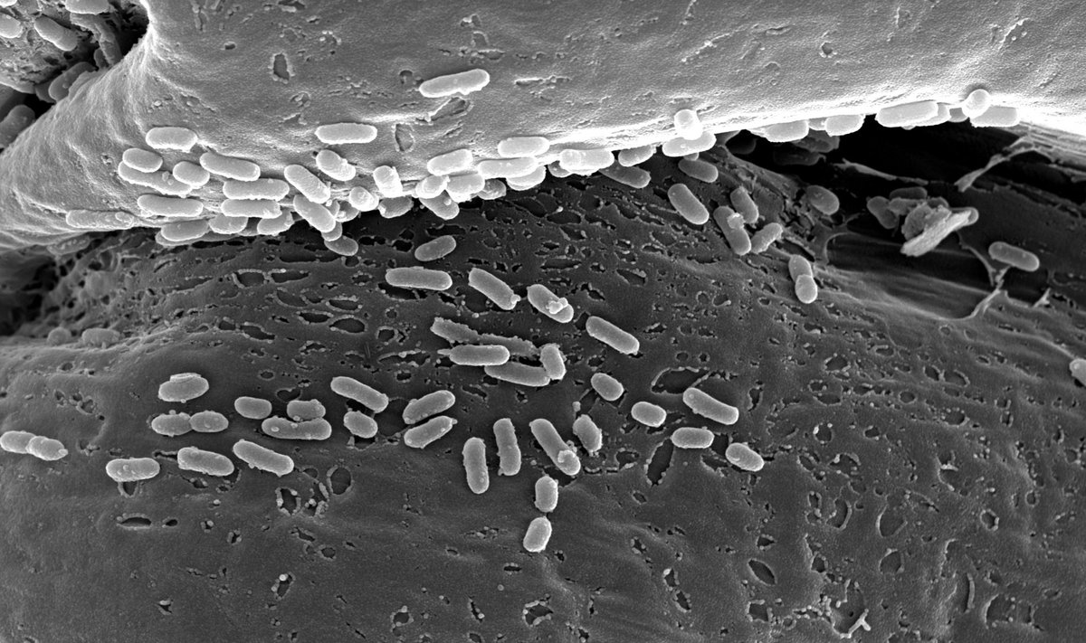 Escherichia coli bakterijos ant audinio