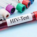 Lietuvoje pirmą kartą bus matuojamas ŽIV stigmos indeksas