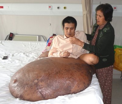 Vietnamietis Nguyen Duy Hai su 90 kg augliu