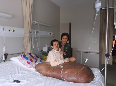 Vietnamietis Nguyen Duy Hai su 90 kg augliu