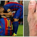 Traumą patyręs L. Messi nežais beveik mėnesį, L. Suarezui – kaltinimai žiauriu žaidimu