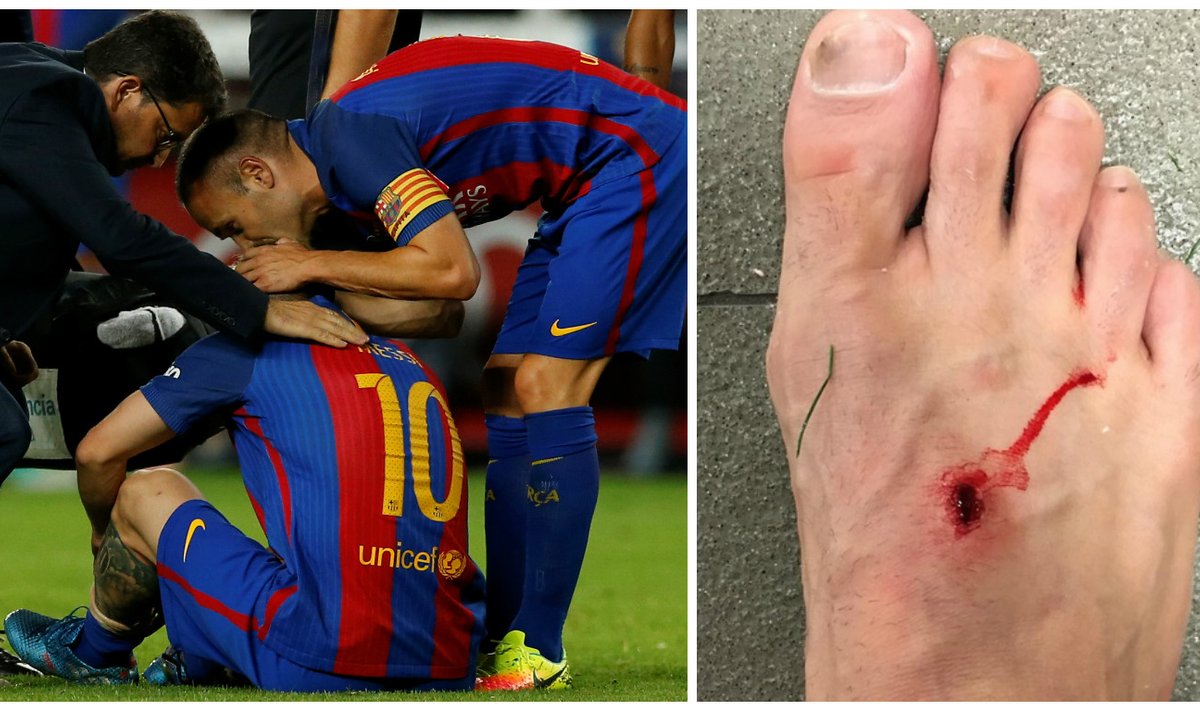 Lionelio Messi trauma, sužeista Filipe Luiso pėda (Reuters-Scanpix, Instagram nuotr.)