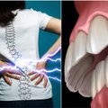 Specialistai įspėja: nugaros skausmų priežastimi gali būti jūsų dantys