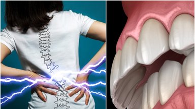 Specialistai įspėja: nugaros skausmų priežastimi gali būti jūsų dantys