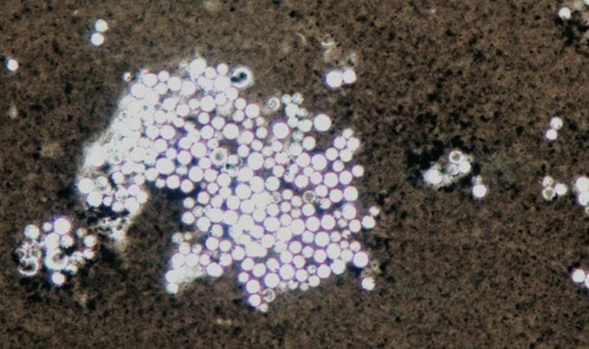 Cryptococcus neoformans grybai