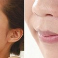 Pamirškite plastines veido operacijas – treniruokitės su guminėmis lūpomis
